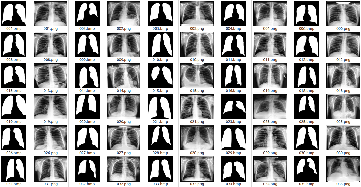 examples-xray-image-segmentation