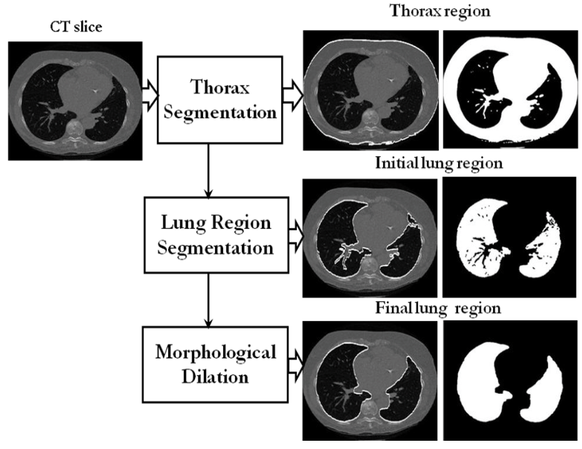 lung_seg